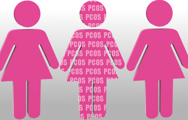 PCOS photo