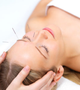 Beautiful young woman with eyes closed receiving acupuncture therapy